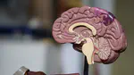 Super-Agers vs Cognitive Decliners